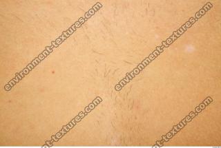 human skin hairy 0010